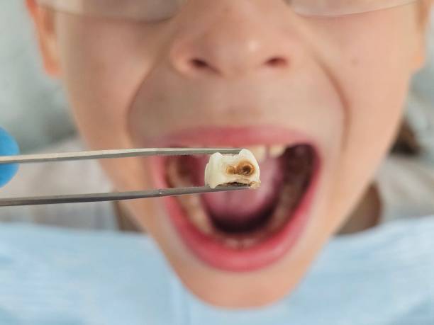 Best Emergency Pediatric Dentist  in Cherokee, IA